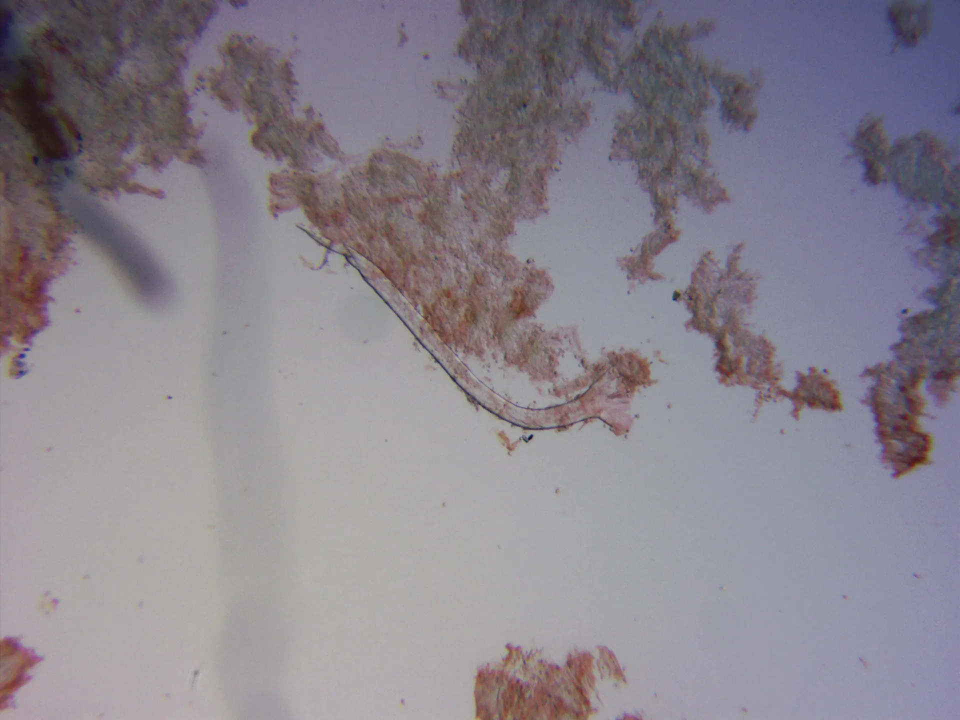 Microscopía de Marasmius cohaerens - 10 - Cistidio laminar x 100